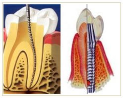 Slider image (3) Dr. Bela Jain Dental Clinic